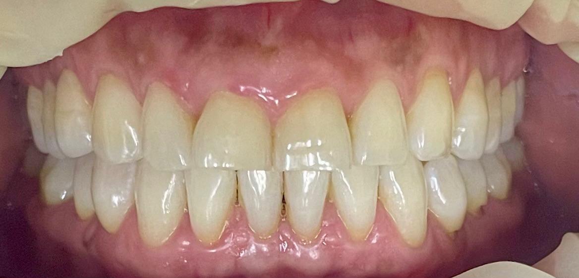 Tratamiento dental profesional